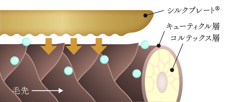 シルクプレート®の説明図